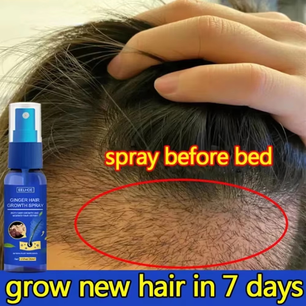 Hair Care For Hair Loss - Fast Ginger Hair Growth Spray Roots
