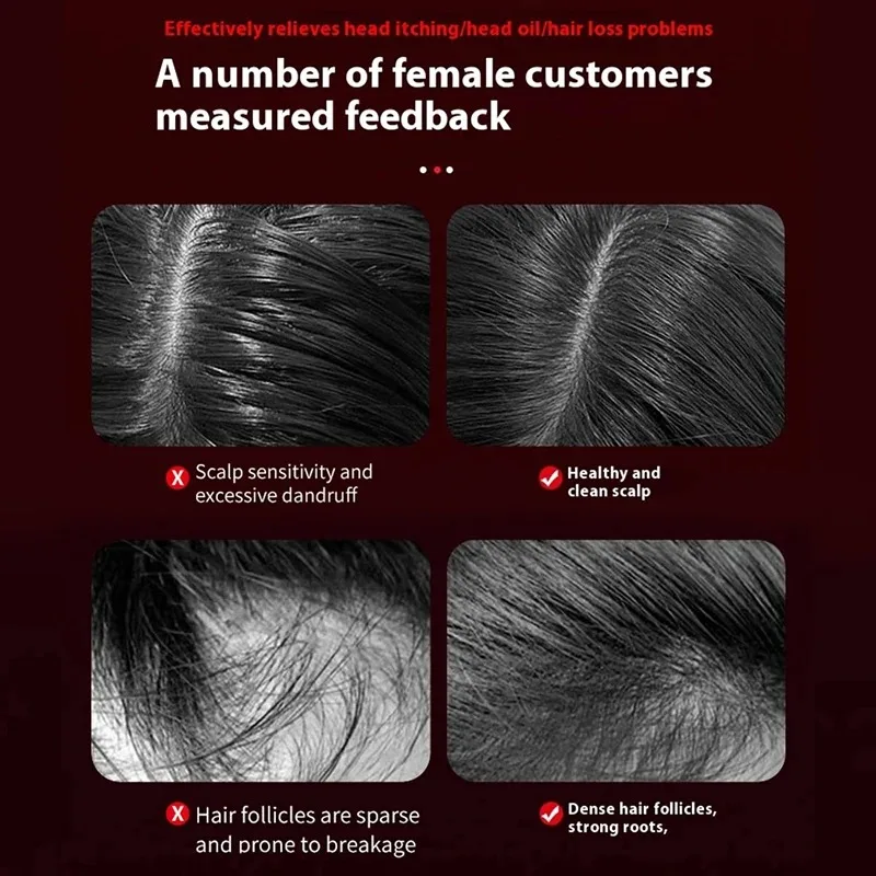 Electric Vibration Massage Com - Hair Care For Hair Loss recension och pris