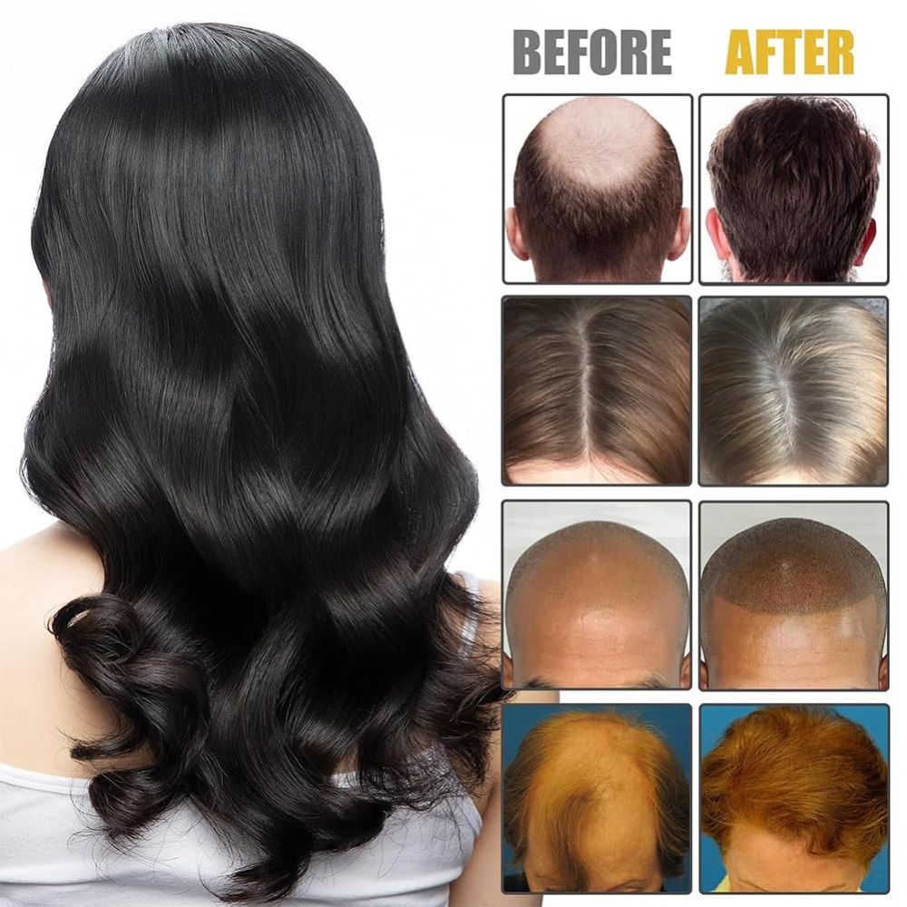 New Nourishes Hair Roots Vorte - Hair Care Formulation recension och pris