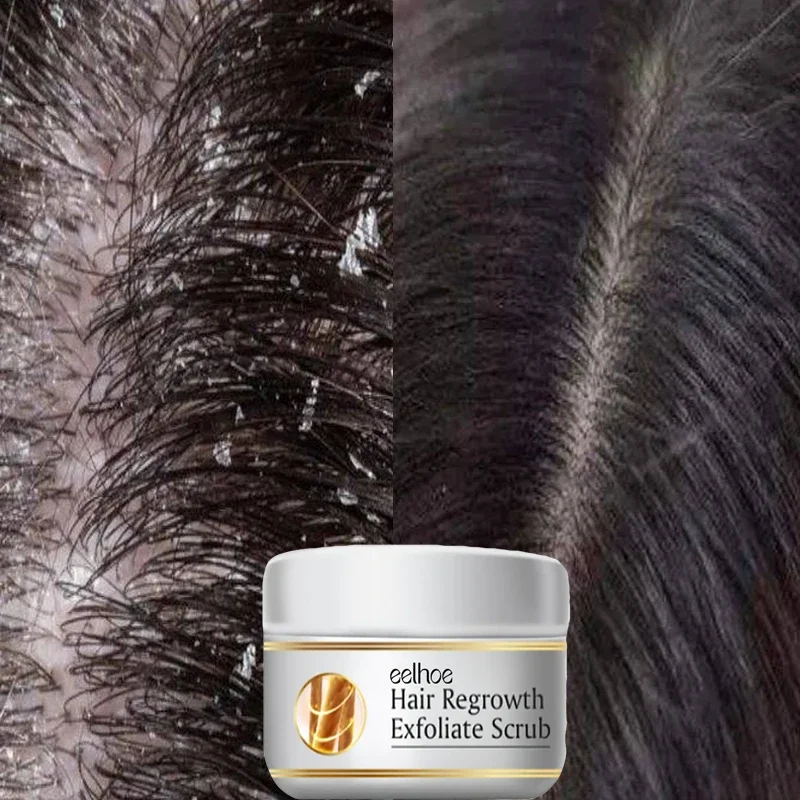 Fast Anti Dandruff Hair Treatm - Scalp Scrub Exfoliant recension och pris
