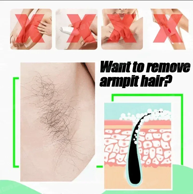 Hair Removal Spray Powerful Ha - Hair Care Korea recension och pris
