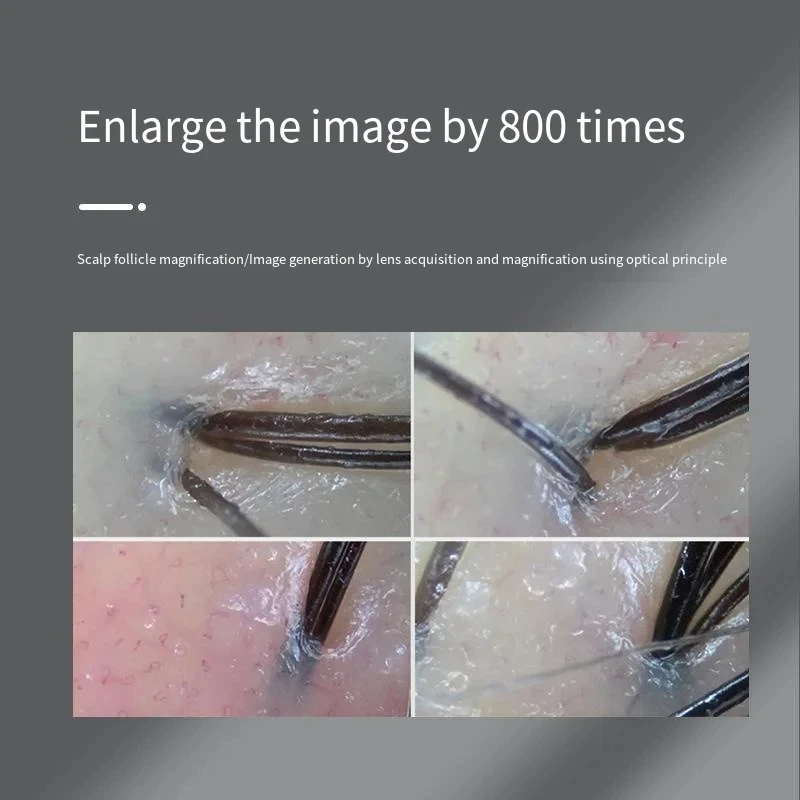 Scalp Hair Follicle Detection  - Hair Porosity Test recension och pris