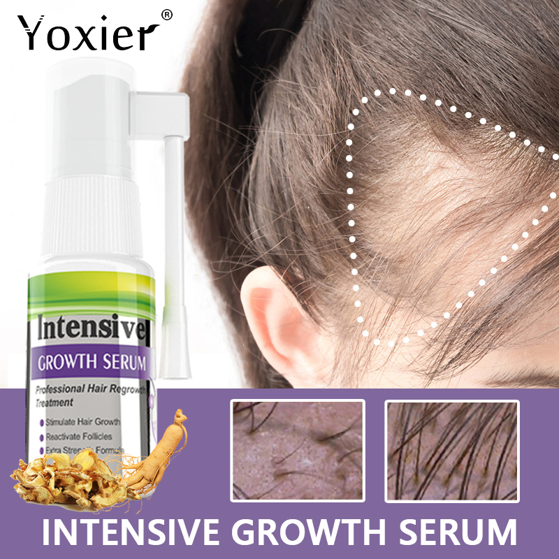 Intensive Growth Serum Prevent - Hair Care For Hair Loss recension och pris