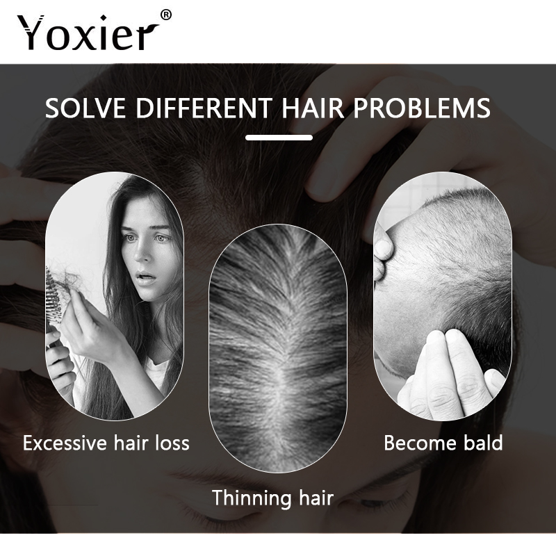 Intensive Growth Serum Prevent - Hair Care For Hair Loss recension och pris