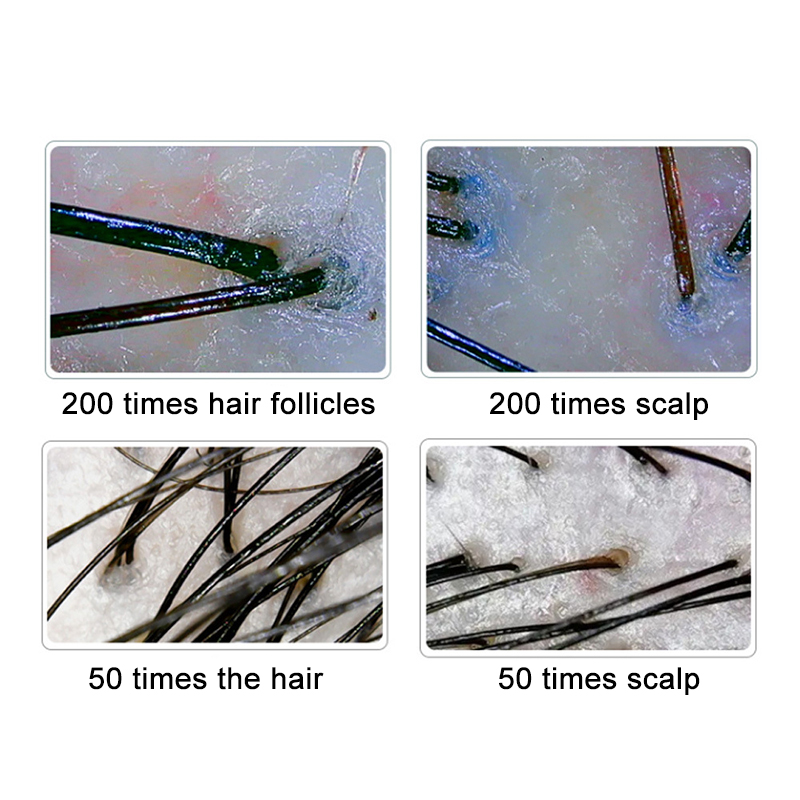 200/50X Skin Hair Scalp Detect - Hair Porosity Test recension och pris