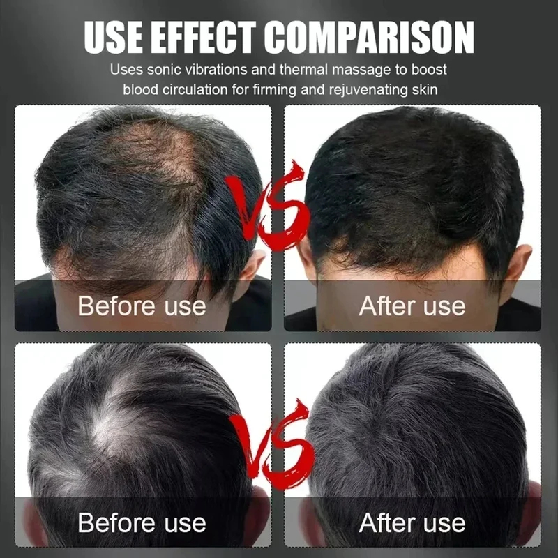 660nm 850nm Red Light Infrared - Hair Care For Hair Loss recension och pris