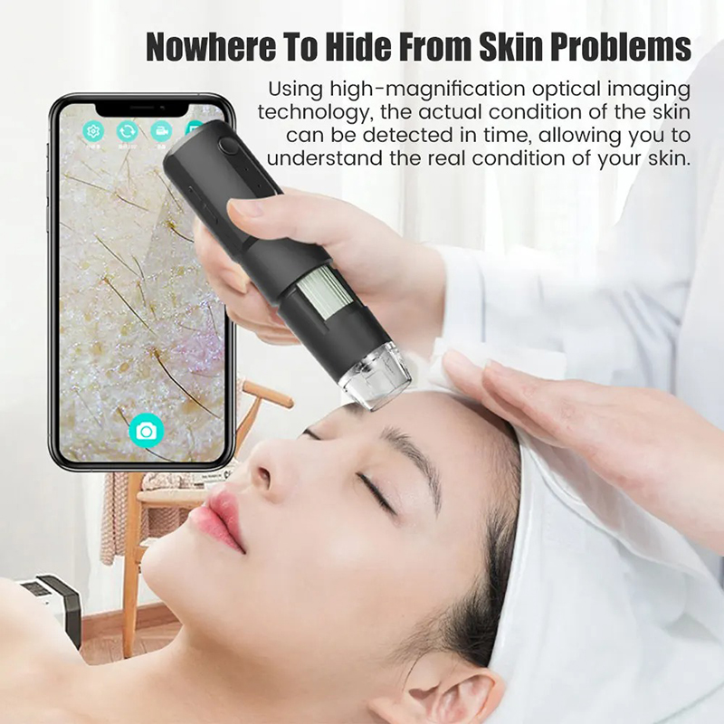Wireless Dermatoscope Scalp Sk - Hair Porosity Test recension och pris